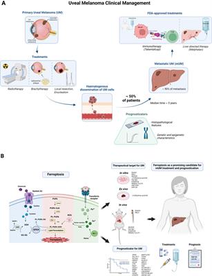 Assessment of ferroptosis as a promising candidate for metastatic uveal melanoma treatment and prognostication